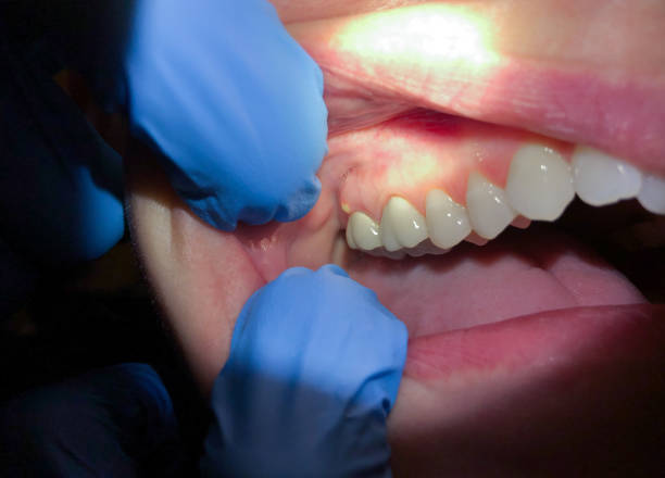 Trusted VA Emergency Dentist Experts